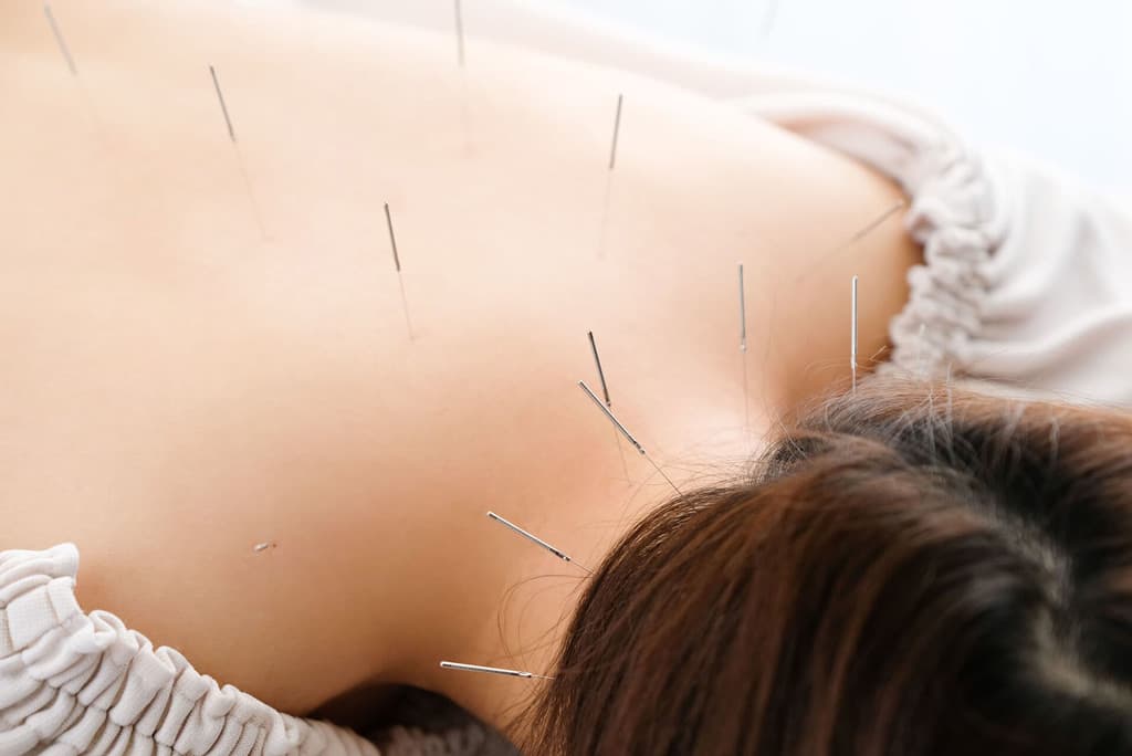 Tratamientos de acupuntura y masajes